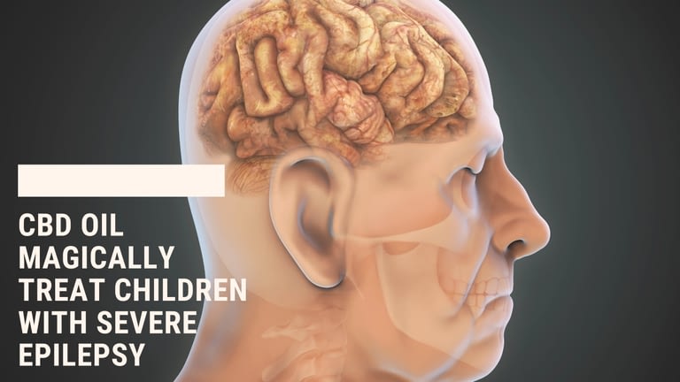 CBD Oil Magically treat Children With Severe Epilepsy