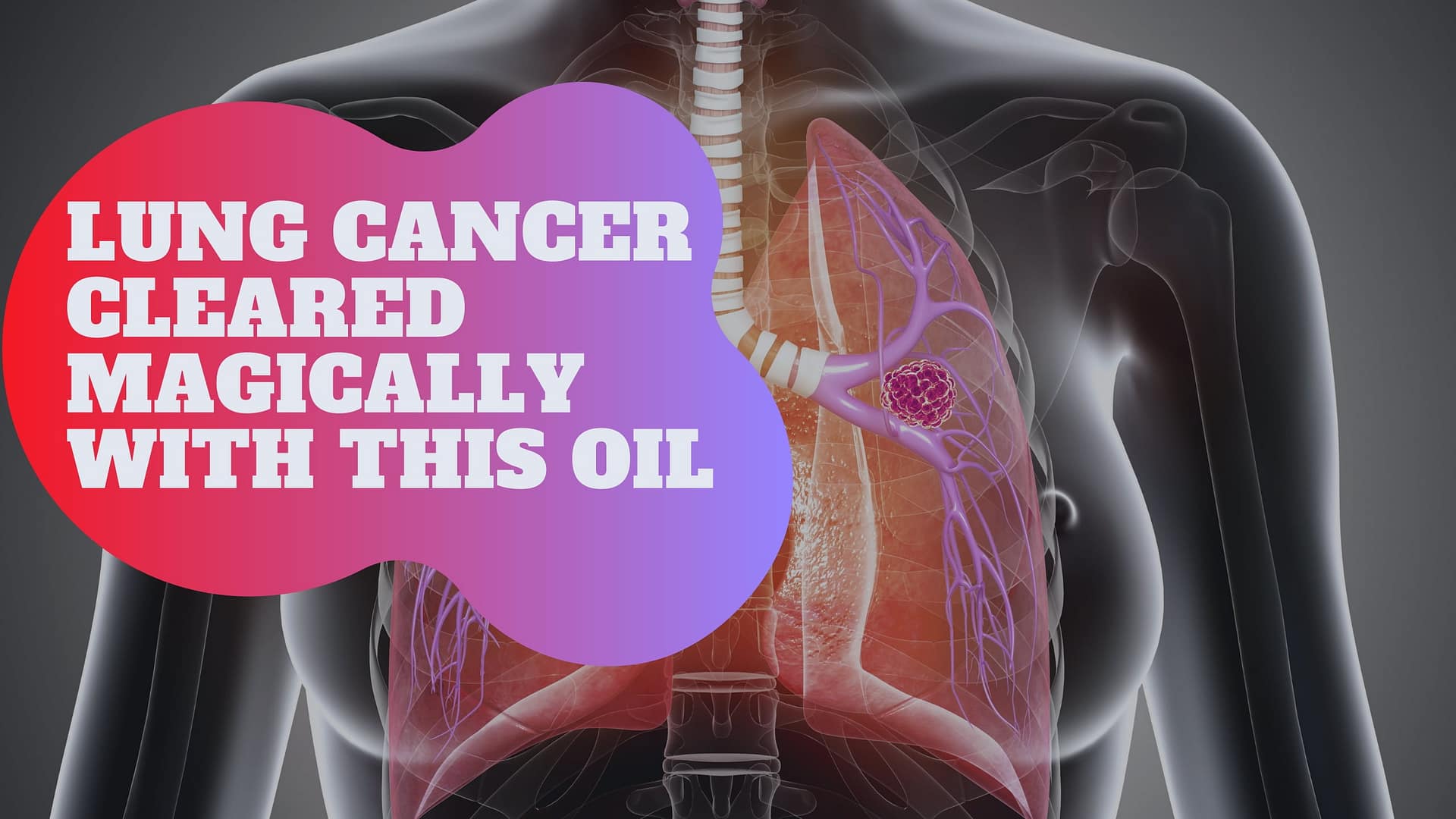 Lung Cancer Cleared Magically With This Oil