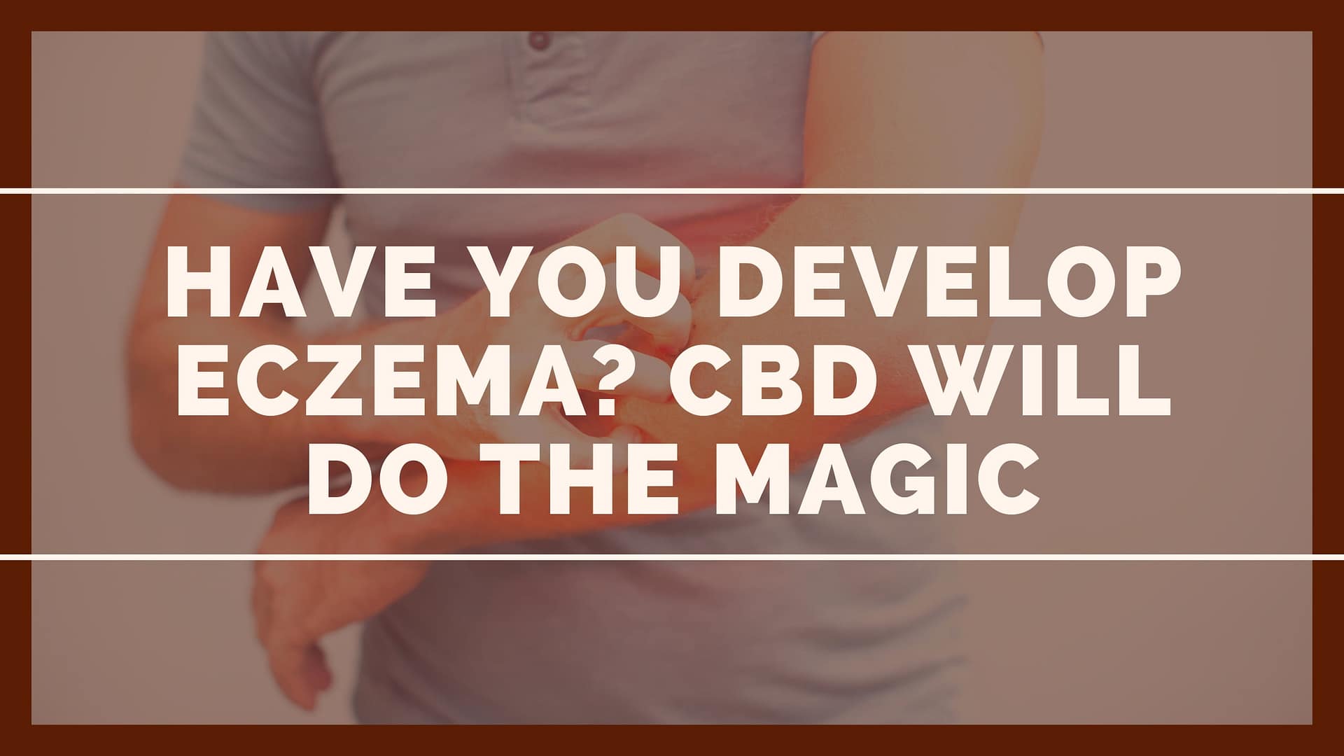 Have You Develop Eczema? CBD will Do the Magic