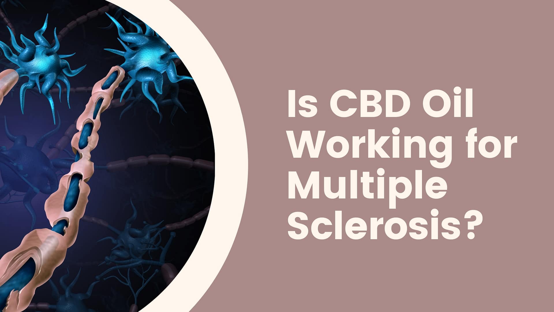 Is CBD Oil Works for Multiple Sclerosis?